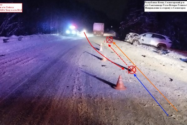 Пострадавший в ДТП на трассе Ухта - Сосногорск водитель Lada Xray находится в коме